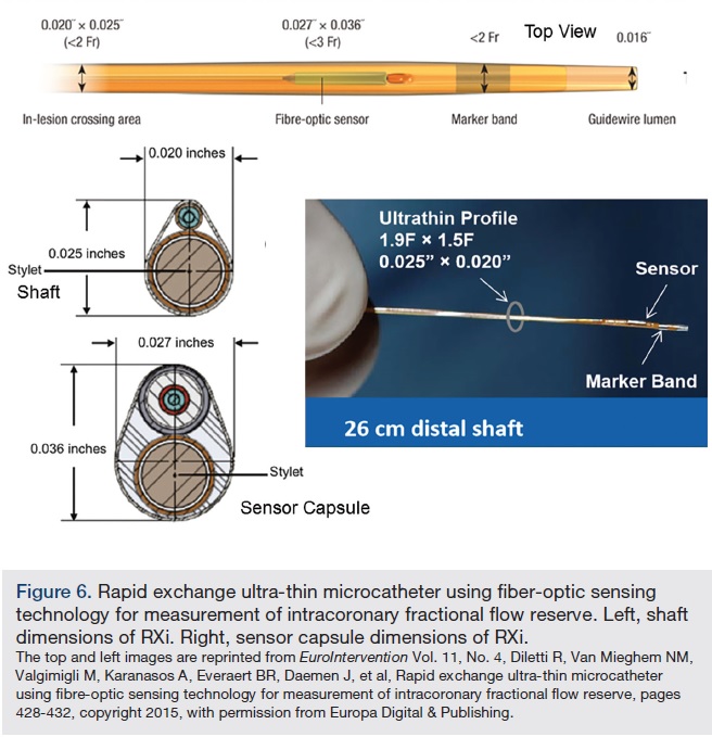 Comparing FFR Tools New Wires and a Pressure Microcatheter
